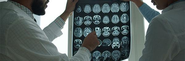 brain injury thumbnail